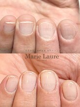 マリーロール 淀屋橋本店(Marie Laure)/自爪育成/深爪矯正/ネイルケア
