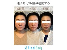 フレキシボディ(FlexiBody)