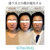 フレキシボディ(FlexiBody)