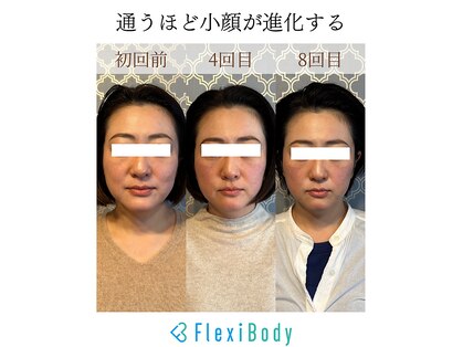 フレキシボディ(FlexiBody)の写真