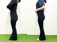 モア 札幌大通店(MORE)/長年の前もものハリが抜けた