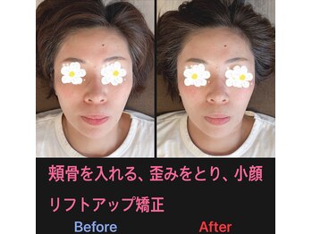 美容矯正サロン レレポノ(LELEPONO)/