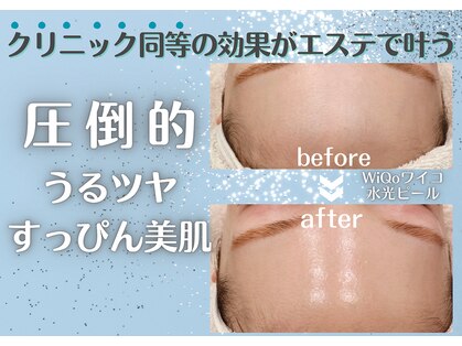 ベルチェリカ(Belle CHERIKA)の写真