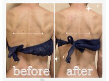 キノン(kinon)/肩甲骨がはがれて天使の羽へ