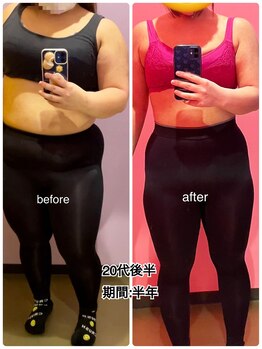 24ダイヤモンドジム 西宮店(24 DIAMOND GYM)/before/after