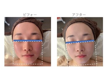 ケンジョビューティーサロン(Kenjo &nbsp;Beauty Salon)/骨格デザイン3D小顔矯正