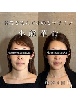 コア 中目黒店(Koa)/お客様ビフォーアフター!!
