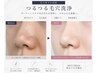 【6月限定】毛穴黒ずみ改善|つるつる毛穴洗浄 ¥8,800