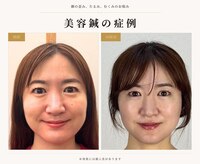 鍼灸院グロリアス 銀座(Glorious)