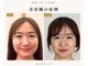 鍼灸院グロリアス 銀座(Glorious)の写真