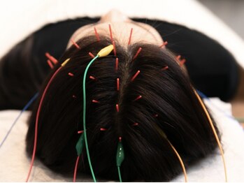 あたまの再起動の写真/《“頭が働かない”と感じていませんか?》鍼×電気で“あたまを再起動“脳疲労を改善し集中力を高めます◎