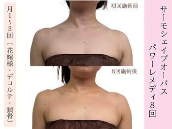 ラエッセ(La Esse)/ブライダル*美しいデコルテへ