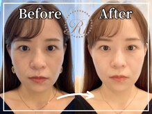 R-1ビューティーサロン 銀座/Before&After　