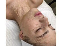 リア(lia)/オプションにゾンビパック