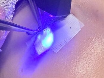 ドットアイサロン(.i salon)の写真/【駅近◆元町駅から徒歩5分】ジェルでつけるＬＥＤエクステ取扱店★下がりまつげでお悩みの方にもオススメ!
