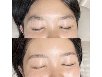 アイリー(IRIE)/ハリウッドブロウリフト