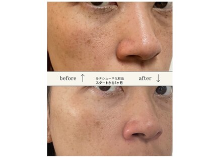 ペリドット(Peridot)の写真