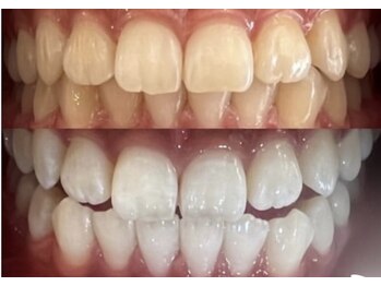 ホワイト 香里園店(WHITE)/3ヶ月後変化《20代》