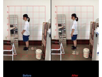 すずらん整体院/姿勢改善