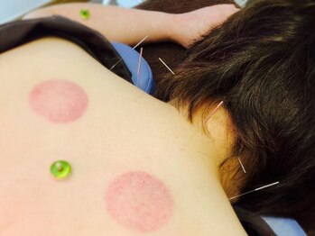 シンシンラボ 豪徳寺(SHINSHIN Lab)/お身体の鍼灸でお悩み改善!