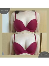 プラス バスト(+Plusバスト)/お客様BeforeAfterお写真