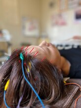 久心宝鍼灸院/キャンペーン☆～とにかく頭～