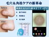 【イチゴ鼻の黒ずみ撃退!】小顔コルギ+カメラ付き毛穴吸引＆洗浄+ヘッド 80分