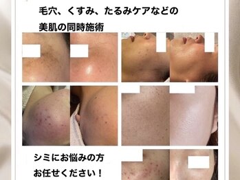 ココ(KOKO)/3回チケットがお得です