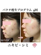 シエル(Ciel)/次世代レチノール《バクチ甦生》