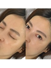 ミィ(mi)/HBL×ふんわり眉