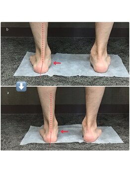 ビオプラス 広尾本店(bioplus)/施術前後に変化