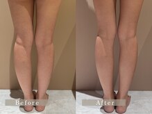 ビム(BIM)/痩身エステ/美脚/東大和市