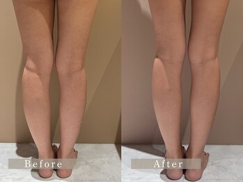 ビム(BIM)/痩身エステ/美脚/東大和市