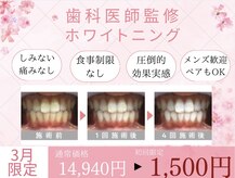 ホワイトニングカフェ 岡崎店(WhiteningCafe)