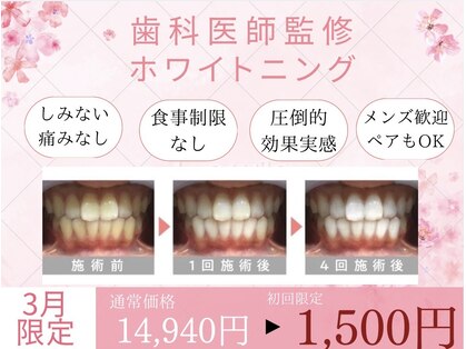 ホワイトニングカフェ 岡崎店(WhiteningCafe)の写真