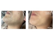 ニコ(nico)/毛量、年齢、肌質寄り添った施術