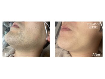 ニコ(nico)/毛量、年齢、肌質寄り添った施術