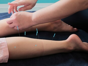 旭堂/女性人気No.1 全身鍼灸60分¥5200