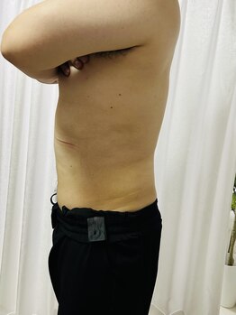 ルフレ 広島(Lufure)の写真/とにかく結果重視！まずは気になる部位を集中ケア♪内臓脂肪でお悩みの方特にオススメです♪