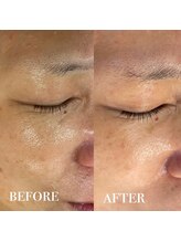 メナードフェイシャルサロン 中萩/