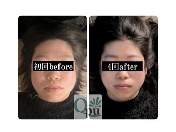 キュープ 浜松店(Qpu)/オイルコース4回での変化