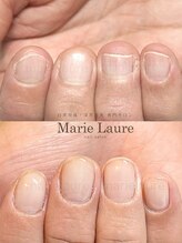 マリーロール 淀屋橋本店(Marie Laure)/自爪育成/深爪矯正/ネイルケア