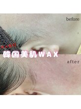 プルティティア(Pultitia)/