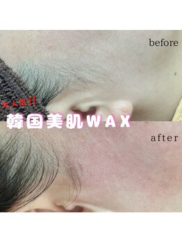 プルティティア(Pultitia)/