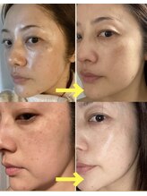 デパートメント(DEPARTMENT)/肌プログラム