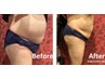 効率良く痩せやすい体へ！【温熱痩身マシン】で初回ダイエット体験