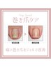 【フット親指巻き爪ケア】痛い巻き爪の方必見◎続けるほどに驚きの変化！