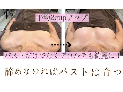 ハーズプラス(hers+)の写真