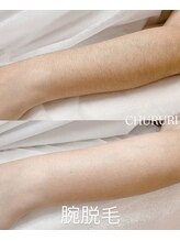 チュルリ 新町店(Chururi)/BODY WAX脱毛