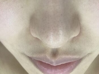 リエー(Relier.)の写真/【毛穴のお悩みの方に♪】皮脂や汚れをしっかり除去し、つるんとした素肌へ導きます◎